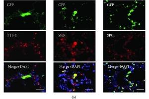 Differentiation of engrafted GFP-labeled ADSCs in the lung of the emphysematous mouse model. (Surfactant Protein C anticorps  (AA 1-193))