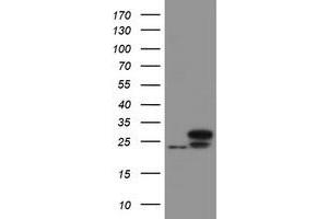 Image no. 1 for anti-Ubiquitin-Conjugating Enzyme E2E 3 (UBE2E3) antibody (ABIN1501625) (UBE2E3 anticorps)