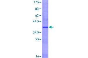 Image no. 1 for Dysbindin (Dystrobrevin Binding Protein 1) Domain Containing 2 (DBNDD2) (AA 1-156) protein (GST tag) (ABIN1351160)