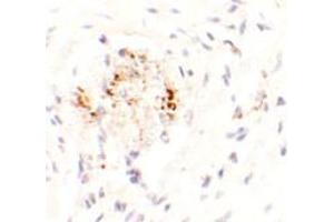 Immunohistochemistry of LEMD3 in human colon tissue with LEMD3 antibody at 2.