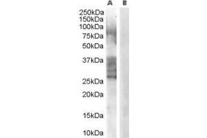 Western Blotting (WB) image for anti-Breast Carcinoma Amplified Sequence 1 (BCAS1) (C-Term) antibody (ABIN2790141) (BCAS1 anticorps  (C-Term))