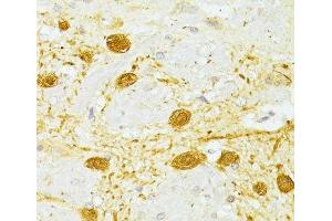 Immunohistochemistry of paraffin-embedded Rat brain using PVALB Polyclonal Antibody at dilution of 1:100 (40x lens). (PVALB anticorps)