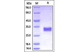Cynomolgus CD40, His Tag on SDS-PAGE under reducing (R) condition.