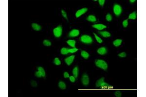 Immunofluorescence of monoclonal antibody to CAMK2A on HeLa cell. (CAMK2A anticorps  (AA 305-410))
