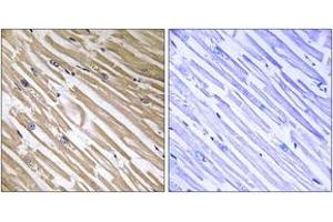 Immunohistochemistry analysis of paraffin-embedded human heart tissue, using NDRG4 Antibody. (NDRG4 anticorps  (AA 187-236))