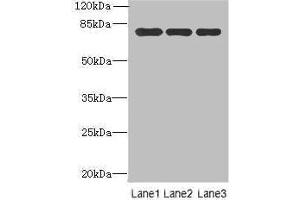 Western blot All lanes: Xaa-Pro aminopeptidase 1 antibody at 8 μg/mL Lane 1: Mouse small intestine tissue Lane 2: Mouse stomach tissue Lane 3: Mouse kidney tissue Secondary Goat polyclonal to rabbit IgG at 1/10000 dilution Predicted band size: 70, 68, 75, 73 kDa Observed band size: 70 kDa (XPNPEP1 anticorps  (AA 2-623))