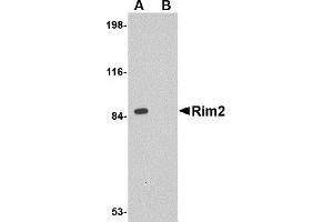 Western Blotting (WB) image for anti-Regulating Synaptic Membrane Exocytosis 2 (RIMS2) (Middle Region) antibody (ABIN1031067) (RIMS2 anticorps  (Middle Region))