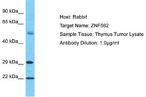 Host: Rabbit Target Name: ZNF562 Sample Tissue: Human Thymus Tumor Antibody Dilution: 1ug/ml (ZNF562 anticorps  (C-Term))
