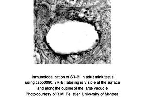 Image no. 2 for anti-Scavenger Receptor Class B, Member 1 (SCARB1) (AA 450-509), (C-Term) antibody (ABIN363399)