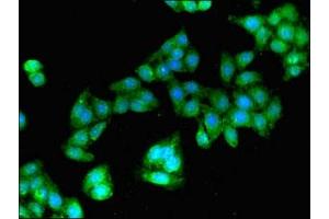 Immunofluorescent analysis of HepG2 cells using ABIN7154773 at dilution of 1:100 and Alexa Fluor 488-congugated AffiniPure Goat Anti-Rabbit IgG(H+L)