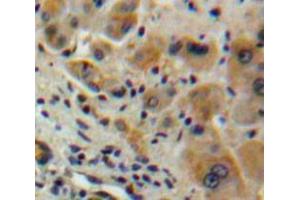 IHC-P analysis of Liver tissue, with DAB staining. (IFNA2 anticorps  (AA 24-188))