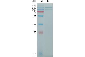 Human LDLR Protein, His Tag on SDS-PAGE under reducing condition.