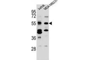 Western Blotting (WB) image for anti-CUGBP, Elav-Like Family Member 3 (CELF3) antibody (ABIN2997134)
