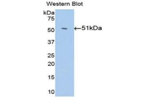Western Blotting (WB) image for anti-Serpin Family C Member 1 (SERPINC1) (AA 159-258) antibody (ABIN3201708) (SERPINC1 anticorps  (AA 159-258))