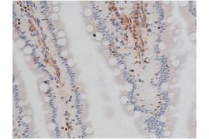 ABIN6267400 at 1/200 staining Rat intestinal tissue sections by IHC-P.