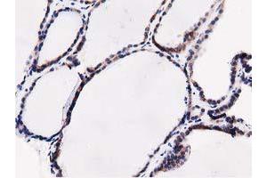 Image no. 6 for anti-Sequestosome 1 (SQSTM1) antibody (ABIN1499989)