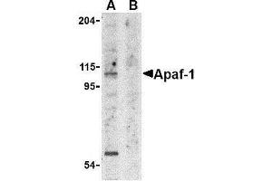 Western Blotting (WB) image for anti-Apoptotic Peptidase Activating Factor 1 (APAF1) (AA 12-28) antibody (ABIN2477457) (APAF1 anticorps  (AA 12-28))
