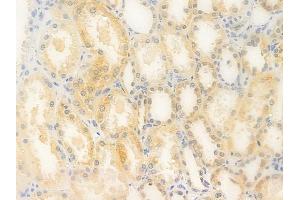 ABIN6263293 and ABIN6276757 at 1/100 staining human normal kidney tissue by IHC-P.