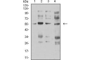 Western blot analysis using CHRNA5 mouse mAb against membrane protein lysate of C6 (1), membrane protein lysate of SK-N-SH (2), membrane protein lysate of C6 (3), and C6 (4) cell lysate. (CHRNA5 anticorps  (AA 23-254))