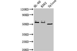 Western Blot Positive WB detected in: HL60 whole cell lysate, K562 whole cell lysate, Mouse spleen tissue All lanes: API5 antibody at 3 μg/mL Secondary Goat polyclonal to rabbit IgG at 1/50000 dilution Predicted band size: 60, 50, 57, 51, 58 kDa Observed band size: 60, 50 kDa (Apoptosis Inhibitor 5 anticorps  (AA 396-524))