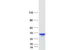 Validation with Western Blot