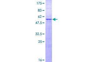 Image no. 1 for Zinc Finger Protein 511 (ZNF511) (AA 20-252) protein (GST tag) (ABIN1326253)