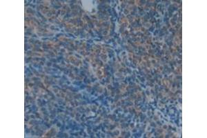 IHC-P analysis of Rat Tissue, with DAB staining. (COMP anticorps  (AA 35-179))