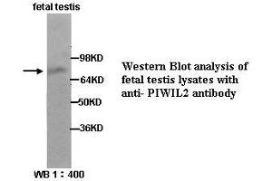 Image no. 1 for anti-Piwi-Like 2 (PIWIL2) (Internal Region) antibody (ABIN790870) (PIWIL2 anticorps  (Internal Region))