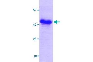 Image no. 1 for Glc8p (GLC8) (AA 1-229) protein (His tag) (ABIN5570424) (Glc8p Protein (GLC8) (AA 1-229) (His tag))