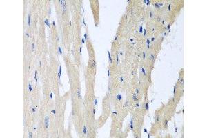 Immunohistochemistry of paraffin-embedded Rat heart using PITRM1 Polyclonal Antibody at dilution of 1:100 (40x lens). (PITRM1 anticorps)