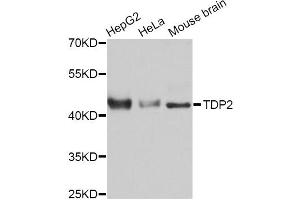 Western blot analysis of extracts of various cell lines, using TDP2 Antibody. (TDP2 anticorps)