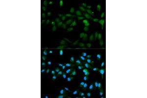Immunofluorescence analysis of MCF7 cell using CYP11A1 antibody. (CYP11A1 anticorps)