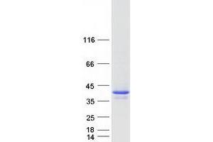 Validation with Western Blot