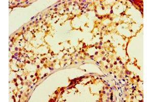 Immunohistochemistry of paraffin-embedded human testis tissue using CHRFAM7A Antibody at a dilution of 1:100. (CHRFAM7A anticorps  (AA 1-150))