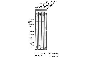 Western blot analysis of Phospho-PLCG1 (Tyr783) expression in various lysates