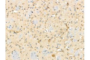 ABIN6259458 and ABIN6275227 at 1/100 staining Mouse brain tissue by IHC-P.