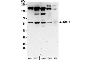 anti-N-Myristoyltransferase 2 (NMT2) (AA 100-150) antibody