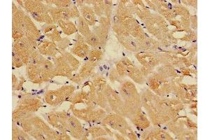 Immunohistochemistry of paraffin-embedded human heart tissue using ABIN7173569 at dilution of 1:100