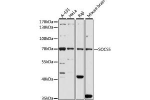Western blot analysis of extracts of various cell lines, using SOCS5 antibody (ABIN6128734, ABIN6148271, ABIN6148272 and ABIN6223959) at 1:1000 dilution.