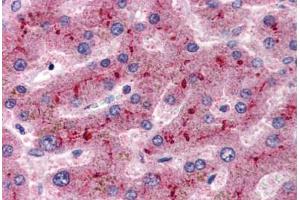 Human Liver (formalin-fixed, paraffin-embedded) stained with CFH antibody ABIN337307 at 2. (Complement Factor H anticorps  (AA 577-588))