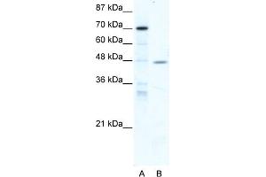 WB Suggested Anti-NR2F6 Antibody Titration:  5. (NR2F6 anticorps  (Middle Region))
