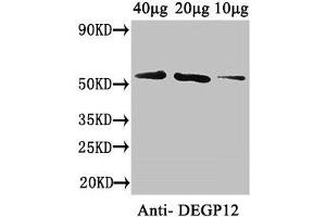 Western Blot Positive WB detected in: Arabidopsis thaliana (40 μg, 20 μg, 10 μg) All lanes: DEGP12 antibody at 3. (DEGP12 anticorps  (AA 25-499))