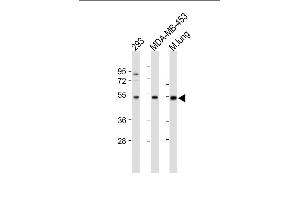 All lanes : Anti-ENT1(Slc29a1)-Ps254 at 1:500-1000 dilution Lane 1: 293 whole cell lysate Lane 2: MDA-MB-453 whole cell lysate Lane 3: Mouse lung tissue lysate Lysates/proteins at 20 μg per lane. (SLC29A1 anticorps  (AA 232-260))