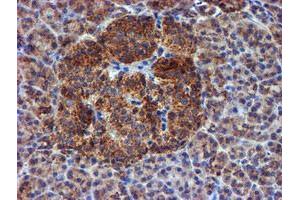 Image no. 10 for anti-NADH Dehydrogenase (Ubiquinone) 1 beta Subcomplex, 9, 22kDa (NDUFB9) (AA 3-179) antibody (ABIN1491359)