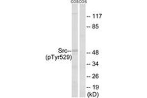 Western blot analysis of extracts from COS7 cells treated with PMA 125ng/ml 30', using Src (Phospho-Tyr529) Antibody. (Src anticorps  (pTyr530))