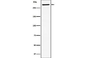 Western blot analysis of EDD expression in SH-SY5Y cell lysate.