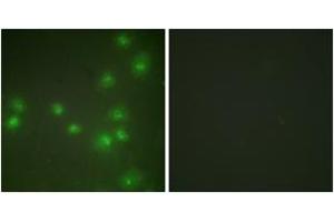 Immunofluorescence analysis of HuvEc cells, using ZNF265 Antibody. (ZNF265 anticorps  (AA 106-155))