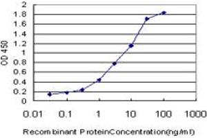 Detection limit for recombinant GST tagged CETN2 is approximately 0.