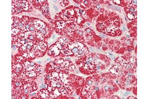 Anti-SLC47A1 / MATE1 antibody IHC staining of human adrenal.