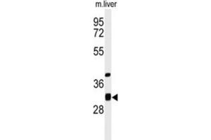 Western Blotting (WB) image for anti-Enoyl CoA Hydratase Domain Containing 1 (ECHDC1) antibody (ABIN3004267) (ECHDC1 anticorps)